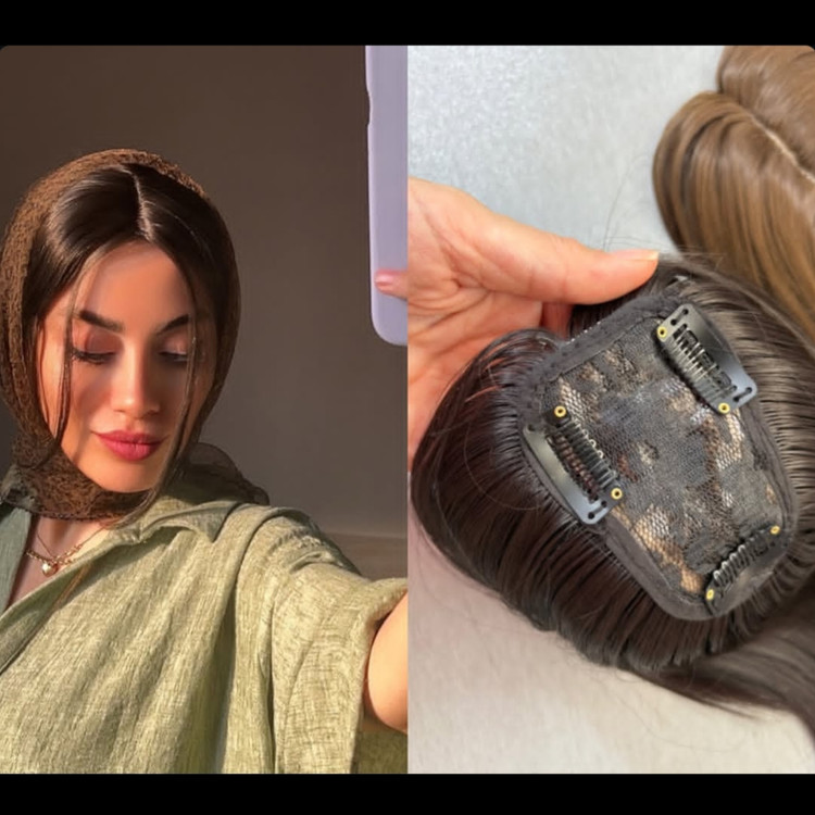پروتز جلوسری فرقدار