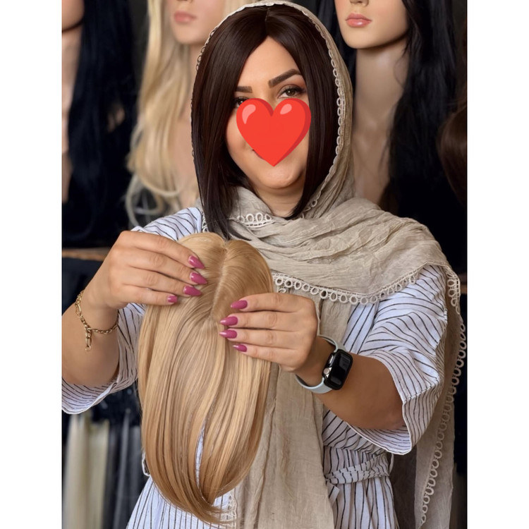 پروتز جلوسری فرقدار