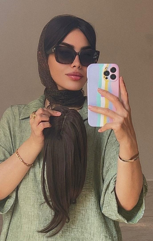 پروتز جلوسری فرقدار