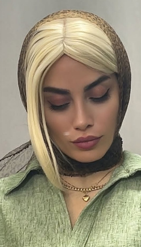 پروتز جلوسری فرقدار