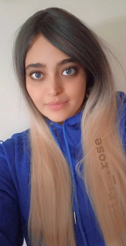 پروتز کفسری آمبره