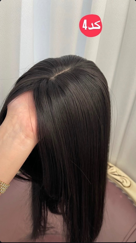 پروتز فرق پوستی طبیعی