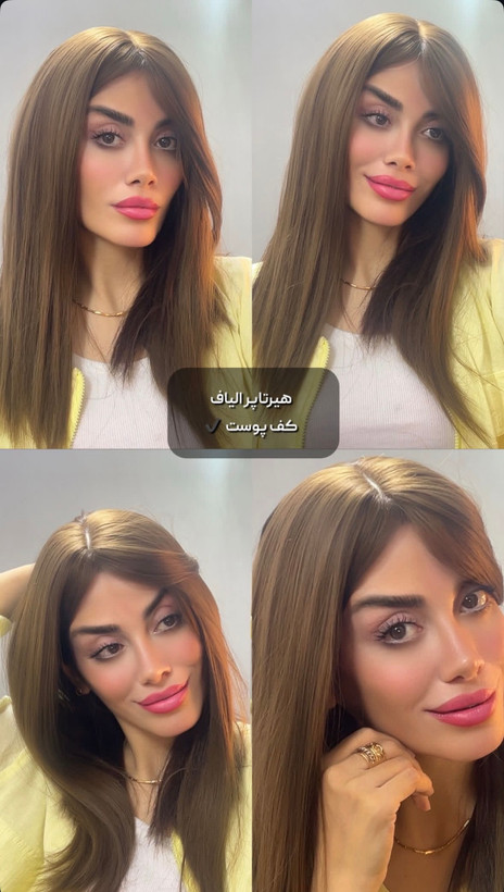 پروتز فرق پوستی طبیعی